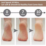 REMOVEDOR ELÉCTRICO DE CALLOS con ENVÍO GRATIS ⭐️⭐️⭐️⭐️⭐️